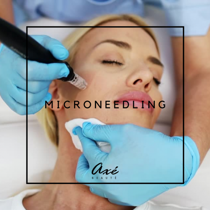 Microneedling visage et cou Microneedling visage et cou