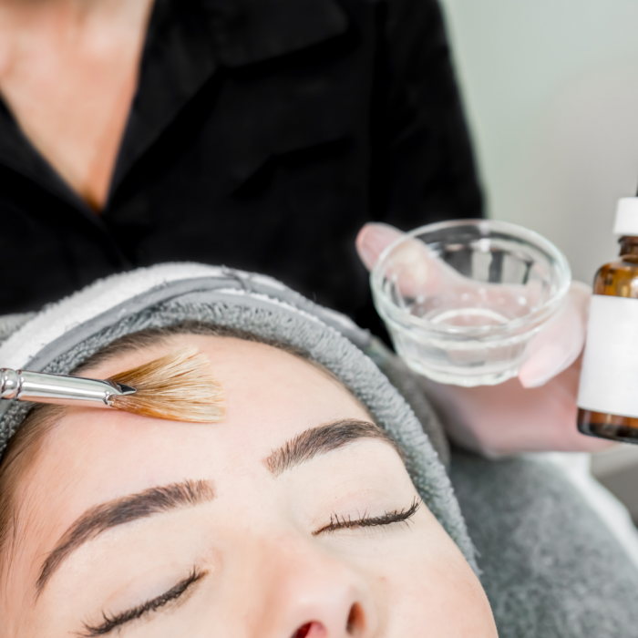 Cure Peeling Chimique