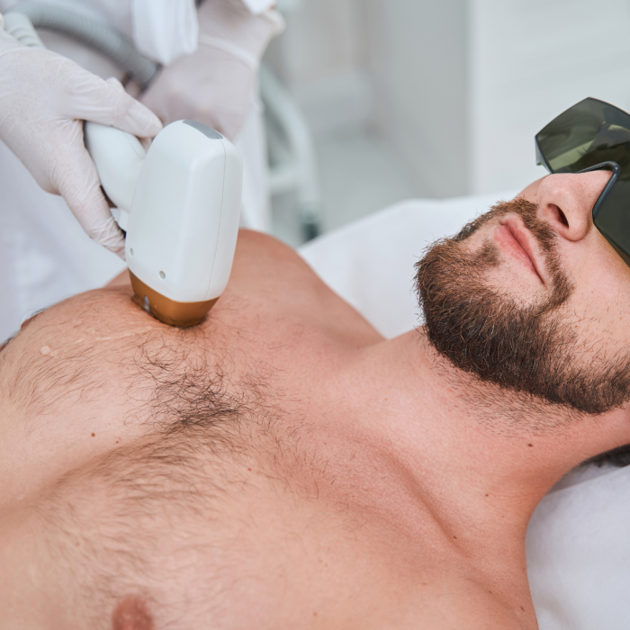 Épilation laser dos OU torse Épilation laser dos OU torse